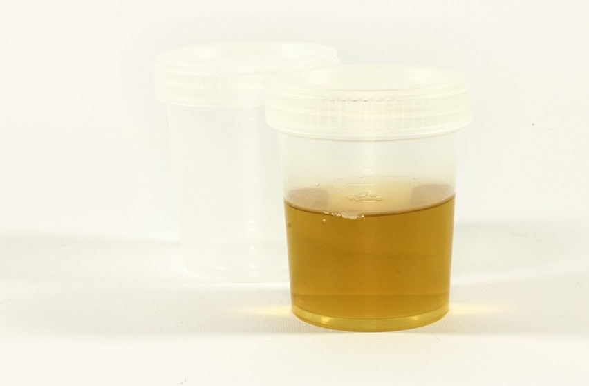 urine cup